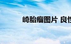 崎胎瘤图片 良性（崎胎瘤图片）